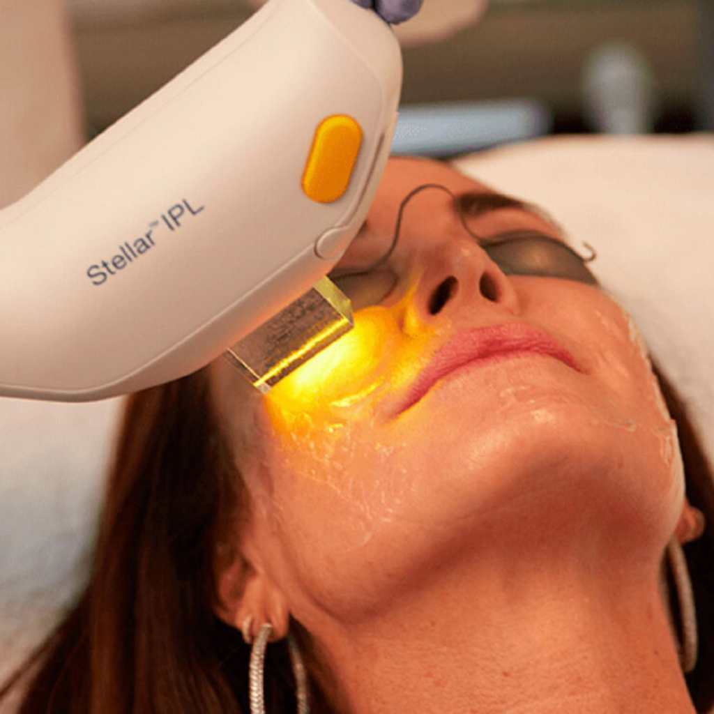 Amazon | STELLA BEAUTE(ステラボーテ) IPL光美容器 2023年
